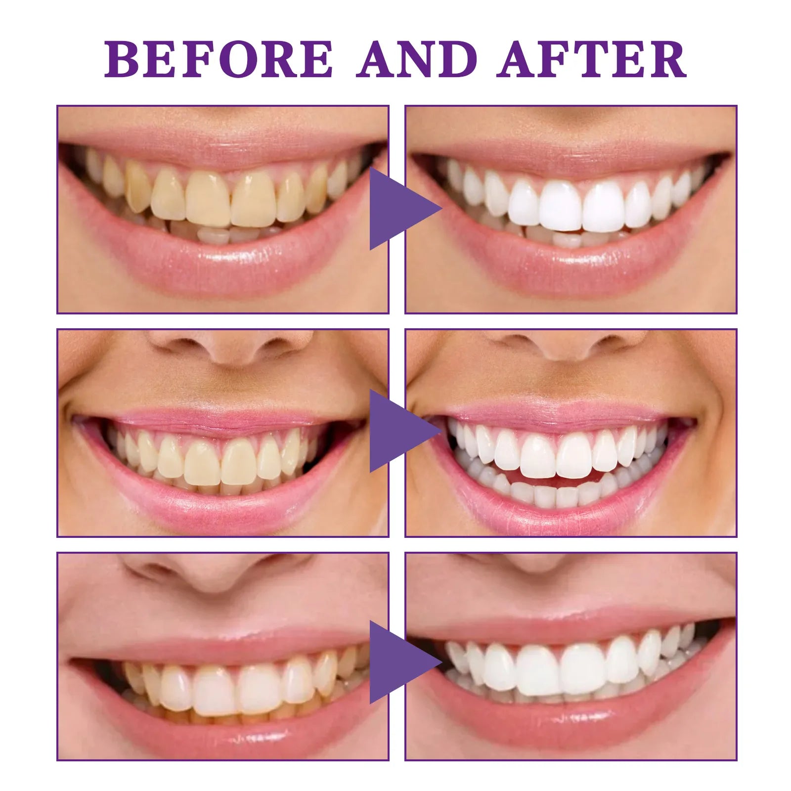 V34 Tooth Cleaning Mousse by Ovriluxe Enterprises llc