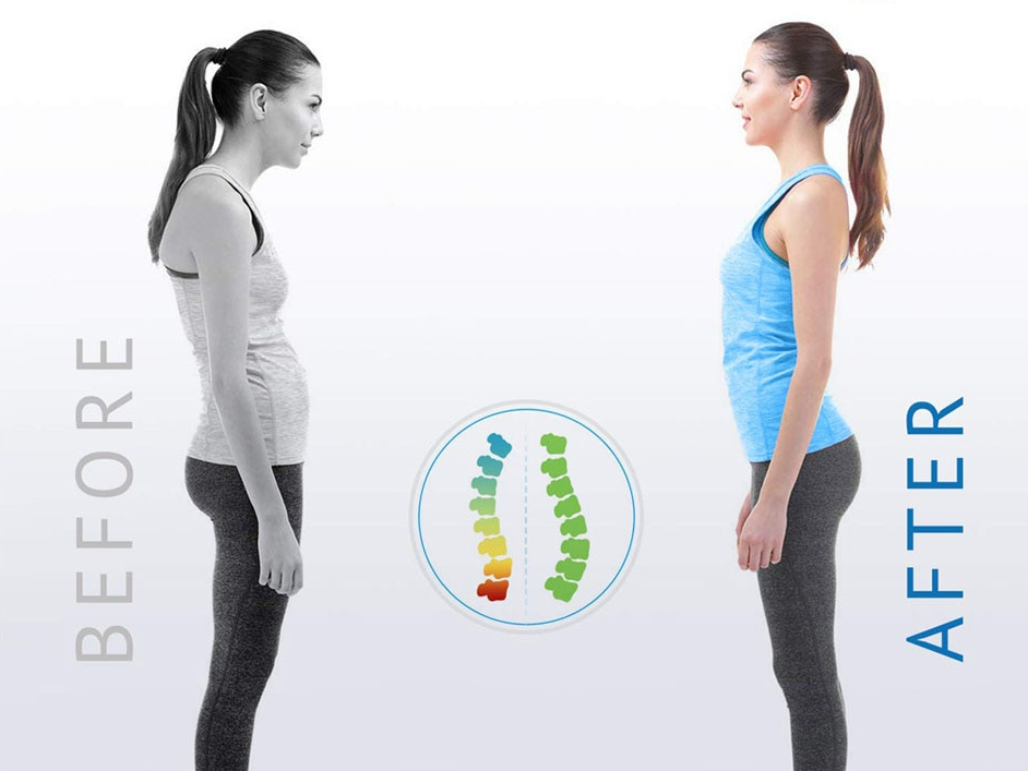Posture Corrector by Ovriluxe Enterprises llc